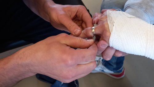 Běžná žádost o pomoc skončila záchranou prstu