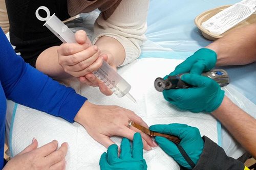 Hasiči zasahovali v ambulanci kvůli prstýnku na nateklém prstu